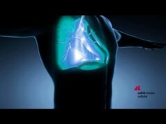 Bronchiectasie, esperti a Milano su malattia cronica diffusa ma spesso trascurata