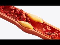 Salute: nuove linee guida dislipidemie, ‘abbassare e stabilizzare colesterolo’