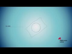 Salute: nuove possibilità nella correzione dei difetti visivi con le lenti Icl