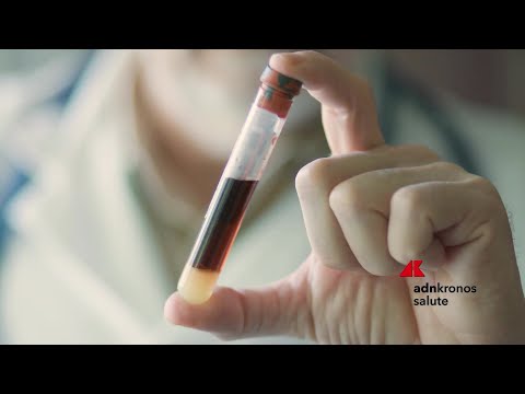 Tumori: seno metastatico, a Milano oncologi e pazienti chiedono accesso equo alla biopsia liquida