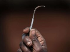 Rivoli, bimbo circonciso a 9 giorni di vita. Genitori del Camerun nei guai Rivoli bimbo circonciso