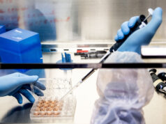 Covid: record di casi (oltre 78mila) ma oltre 1 milione di tamponi vaccino italiano covid