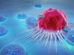 Meno contagi tra chi fa immunoterapia per melanoma immunoterapia per melanoma