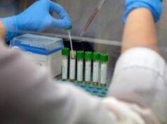 Mers, 9 casi con due morti in Arabia Saudita. Oms: “Rischio moderato”