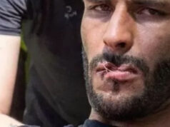 Khalil Qahir: si cuce la bocca con ago e filo per protesta Khalil Qahir