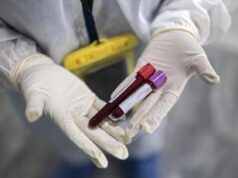 Super gonorrea resistente agli antibiotici, è allarme in Europa