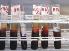 Aids, l’accusa di Bassetti: “Torna a far paura per colpa di Trump”