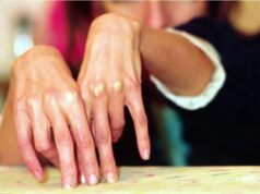 ‘Disturbi alimentari stanno diventando incurabili per scelta politica’, lo sfogo