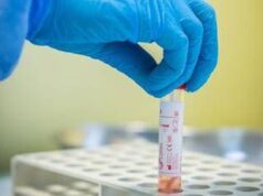 Covid, cacciatore italiano di varianti: “Così ho intercettato Nimbus”