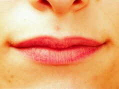 Terapia genica contro l’herpes labiale: cura sperimentale elimina il 90% del virus