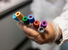 Boom di infezioni sessualmente trasmesse in Europa: su sifilide, gonorrea e clamidia