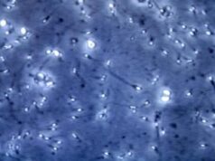 Allarme inquinamento a Milano, l’esperto: “Alto rischio infertilità sia maschile che femminile”