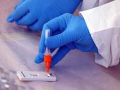 Covid e Natale, Pregliasco: “Tampone pre-cenoni, a prescindere dai sintomi”