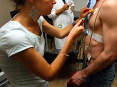 Infarto, studio ridimensiona efficacia beta-bloccanti