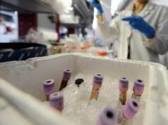 Prevedere cancro ovaio con anni d’anticipo, speranza da studio italiano