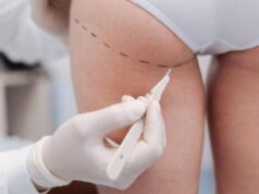 Chirurgia estetica, via l’Iva sugli interventi