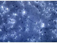 Infertilità maschile, dietro c’è gene mancante: spermatozoi sono ‘sconnessi’