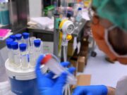 Legionella, il batterio che ama tubature e condizionatori: casi in aumento in Italia