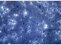 Microplastiche nella prostata e nel liquido seminale, la scoperta italiana: cosa comporta