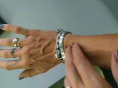 Nuovi indizi sul mistero del prurito, sotto accusa un inedito ‘colpevole’