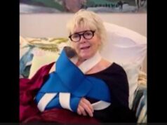 Caterina Caselli inciampa nei cavi dell’albero in Galleria a Milano e si rompe l’omero: “E’ pericoloso”