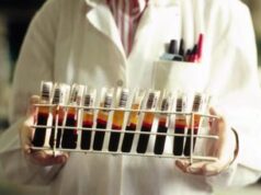 Egpa, il reumatologo: “Con monoclonali remissione in oltre 90% casi”