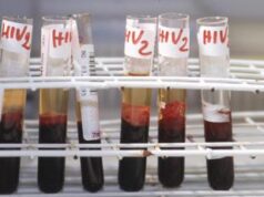 Otto persone su 10 con Hiv sviluppano disturbi di salute mentale, al via campagna