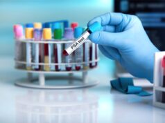 Tumori, Mazzotti (Janssen Italia): “Con informazioni accurate al fianco di pazienti”