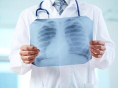 Ipertensione polmonare, giornata di sensibilizzazione a Roma