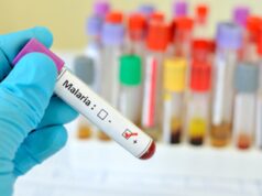 Sanità, Oms: “Capo Verde malaria-free, traguardo storico”