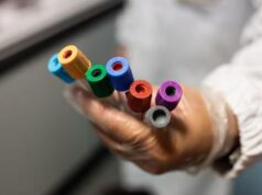 Svelare l’Alzheimer 15 anni prima dei sintomi, la speranza in un esame del sangue