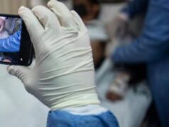 Vaiolo delle scimmie, undici casi a Firenze: cosa sappiamo