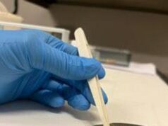 Ricerca: arti bionici funzionanti e senza rigetto, Università Ferrara in progetto Ue