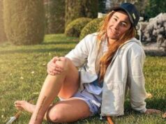 Sofia Goggia e l’infortunio, mostra foto cicatrice: “Questo dolore non sarà invano”