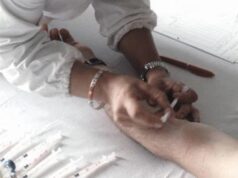 Allergia al nickel in aumento, l’immunologo “nuoce al 10% della popolazione”