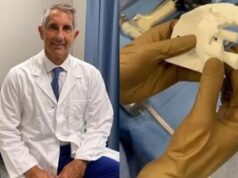 Chirurgia, protesi di spalla rovinata sostituita con un modello personalizzato