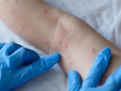 Dermatologi, subito task force per formare medici su Ai