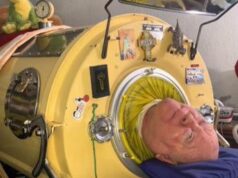 E’ morto Paul Alexander, aveva 78 anni: per tutta la vita nel polmone d’acciaio