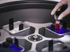 Hiv eliminato da cellule infette con editing genetico: lo studio