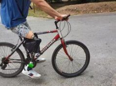 Protesi ortopediche triplicate e 20mila l’anno scadono, boom revisioni