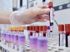 Tumore allo stomaco in stadio precoce, con immunoterapia 69% pazienti vivo a 3 anni