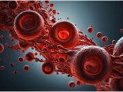 Mieloma multiplo, rimborso per Car-T cilta-cel nella seconda linea di trattamento