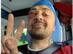 Chef Rubio aggredito sotto casa: “Mi hanno massacrato di botte”