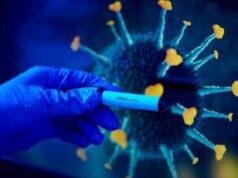 Covid, Andreoni: “Infezione può scatenare malattie autoimmuni, Mip-C non sarà l’unica”