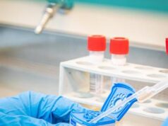 Covid, Bassetti al ministero: “Basta bollettino, oggi è inutile e dannoso”