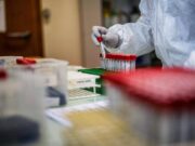 Covid, l’Aspirina frena l’attacco del virus e limita il danno ai polmoni: l’ultimo studio