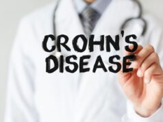 Malattia di Crohn, ok Aifa a rimborsabilità in Italia di upadacitinib