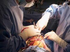 Poliziotto ferito a Milano, 5 ore di intervento e 100 trasfusioni: così è stato salvato Di Martino