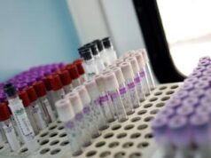 Ricerca, proteina sangue albumina predice rischio cancro e infarto in ‘over 65’