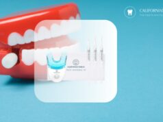 Come sbiancare i denti velocemente?